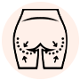 skn